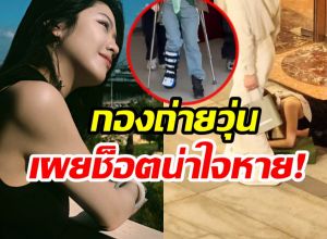 สุดห่วง! นางเอกดังสะดุดล้มหน้าคว่ำ ต้องใส่เฝือกอ่อน