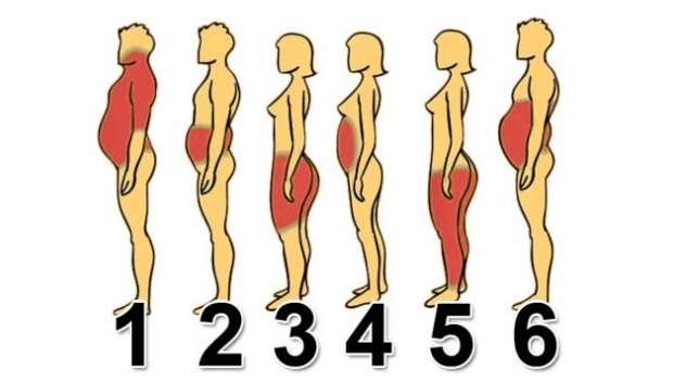คุณอ้วนแบบไหน ลดความอ้วนให้ถูกวิธี
